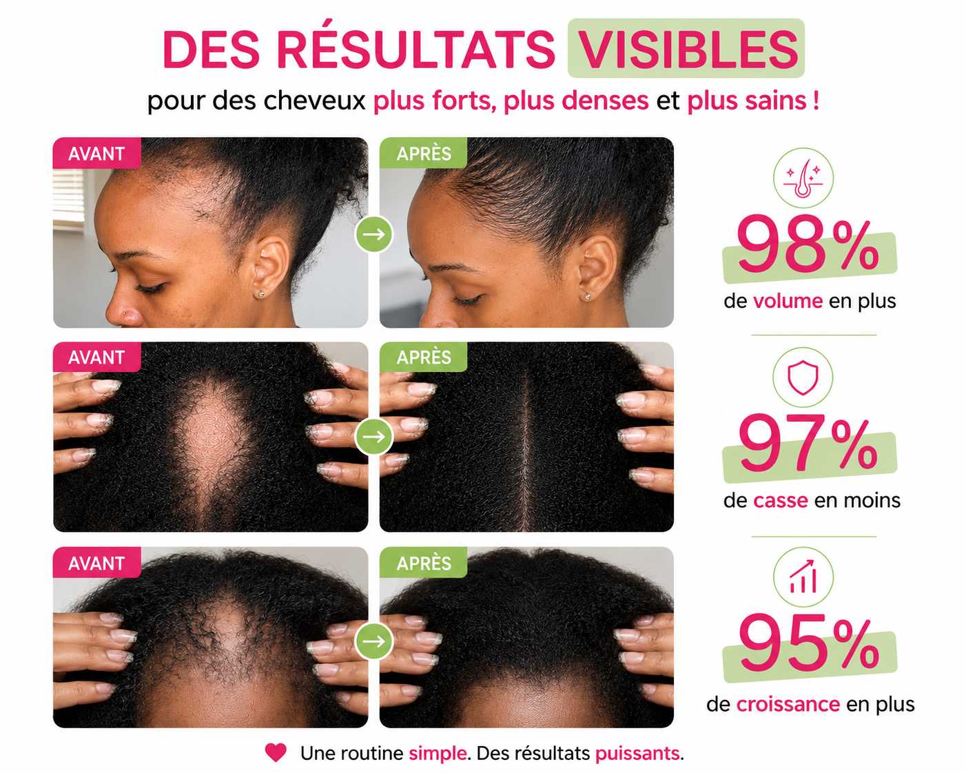 Huile nourrissante et pousse cheveux crépus - Élixir Long hair oil 200ml - Wonderful hair