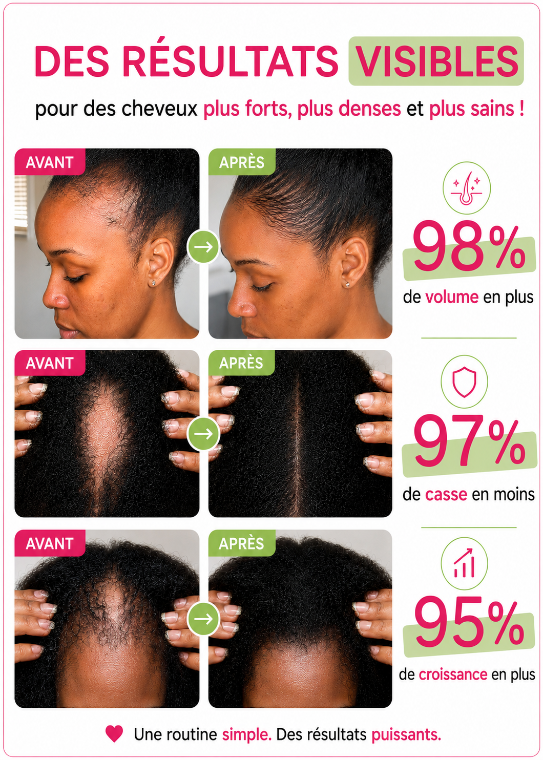 Huile nourrissante et pousse cheveux crépus - Élixir Long hair oil 200ml - Wonderful hair